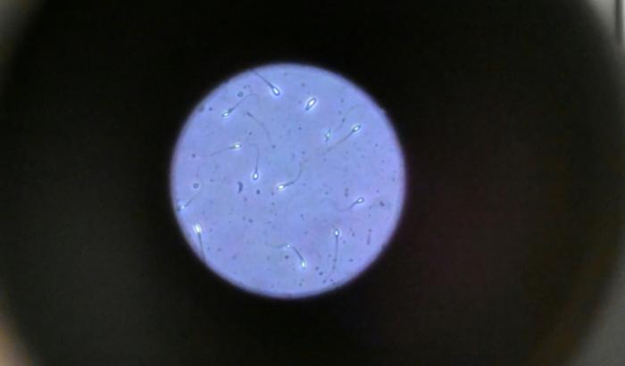 Des spermatozoïdes humains observés au microscope, le 17 novembre 2024 à Rennes
