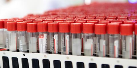 Krankmachende Viren in Patientenproben können künftig schneller identifiziert werden. Forscher des Robert-Koch-Instituts entwickelten ein neues Verfahren, mit dem Proben auf hunderte verschiedene Viren gleichzeitig untersucht werden können.