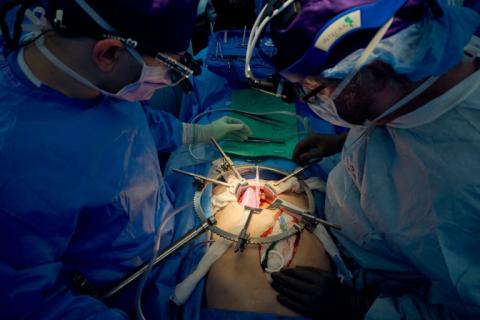 Des chirurgiens de l'hôpital NYU Langone de New York transplantent un rein de porc génétiquement modifié sur un patient en état de mort cérébrale, le 14 juillet 2023