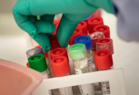 Die Weltgesundheitsorganisation (WHO) hat ihre höchste Alarmstufe für die Infektionskrankheit Mpox aufgehoben. Zuletzt war die Zahl der Krankheits- und Todesfälle weltweit deutlich zurückgegangen.