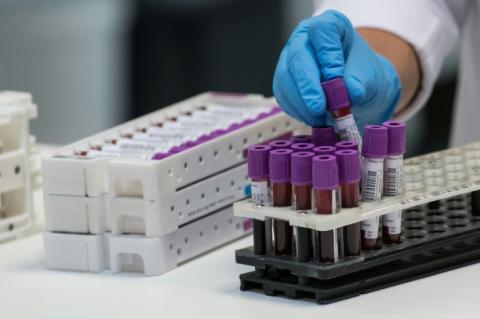Cette technologie, également appelée de l'ADN tumoral circulant, consiste à suivre l'évolution d'un cancer par une simple prise de sang - et non par biopsie classique