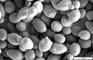 Saccharomyces cerevisiae_SEM