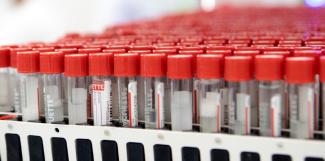 Krankmachende Viren in Patientenproben können künftig schneller identifiziert werden. Forscher des Robert-Koch-Instituts entwickelten ein neues Verfahren, mit dem Proben auf hunderte verschiedene Viren gleichzeitig untersucht werden können.