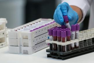 Cette technologie, également appelée de l'ADN tumoral circulant, consiste à suivre l'évolution d'un cancer par une simple prise de sang - et non par biopsie classique